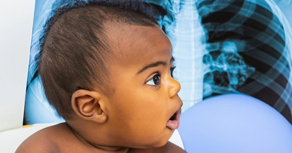 Respiratory distress is the best predictor of pneumonia on chest x-ray in febrile infants